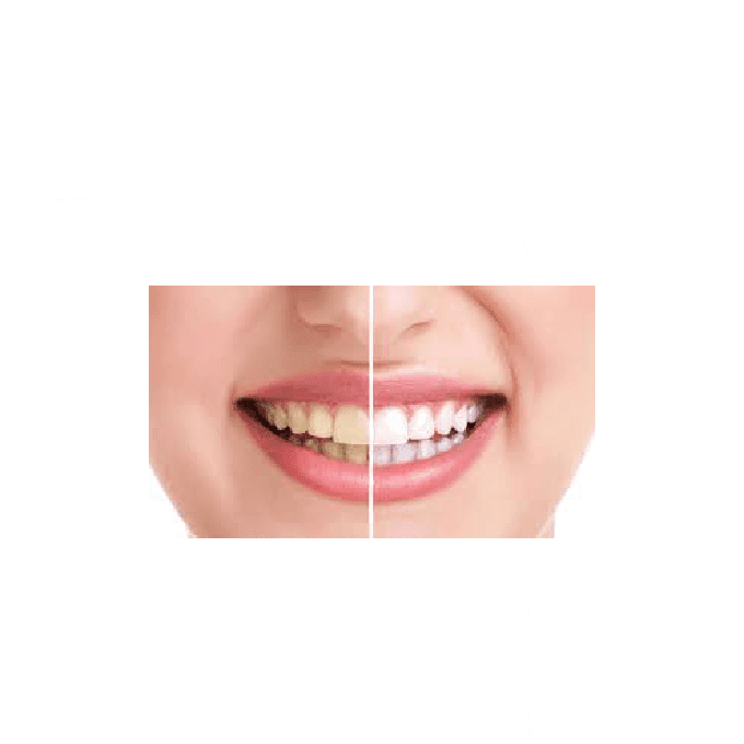 مناديل ويلزياد لتنظيف الأسنان - عبوة 12 منديل