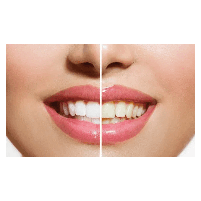 معجون أسنان وايت قلو بتبييض فائق