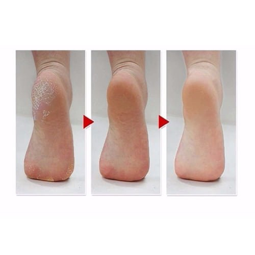 جوارب لتقشير القدمين من ماركة ام بيوتي