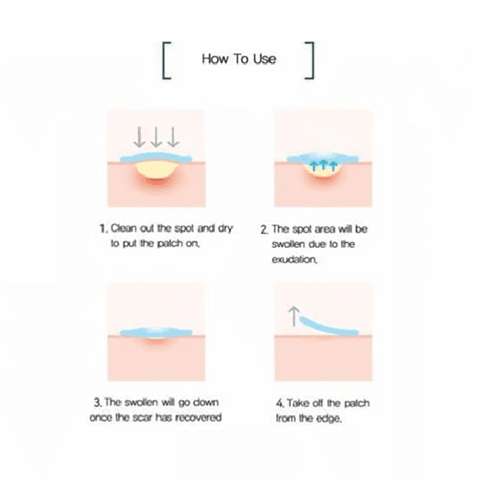 لصقات سوم باي مي المعجزة لعلاج الحبوب وآثارها - 30 يوماً، 18 قطعة لاصقة