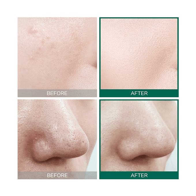 تونر عناية البشرة AHA BHA PHA من سوم باي مي - 150 مل