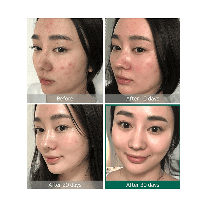 تونر عناية البشرة AHA BHA PHA من سوم باي مي - 150 مل